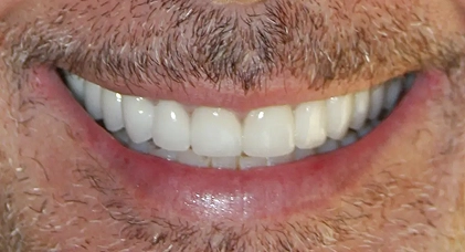 Dental Cleaning in Chinatown